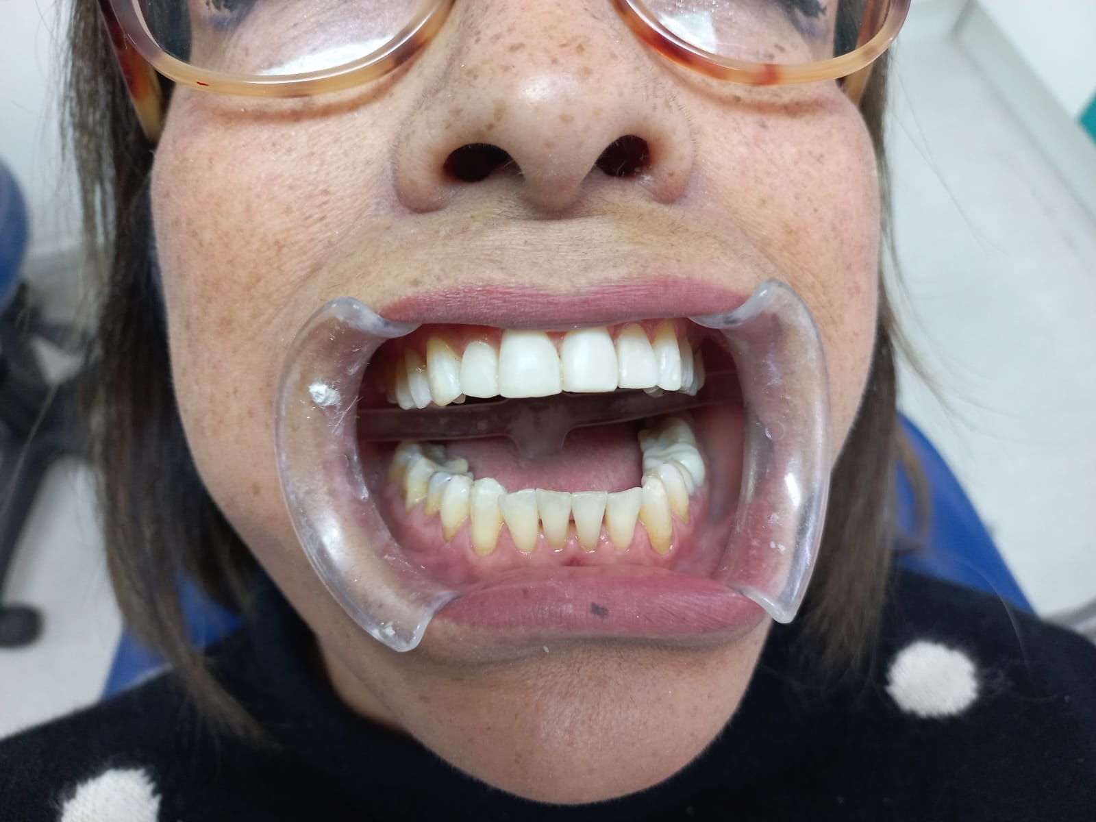 Descripción de la imagen 3